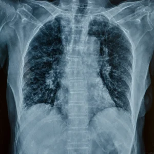 Radiología